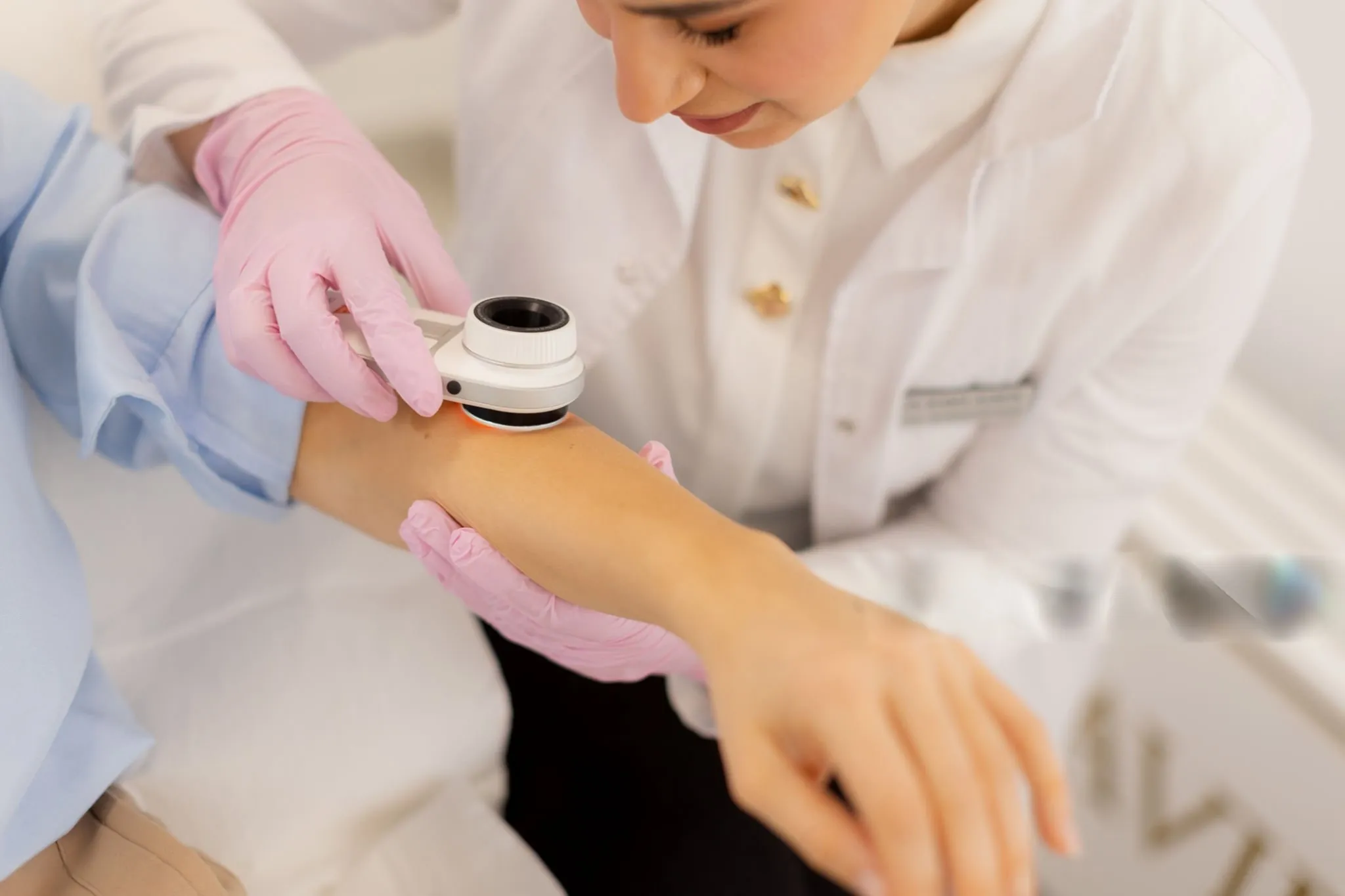 Diathermy of Warts & Skin Lesions