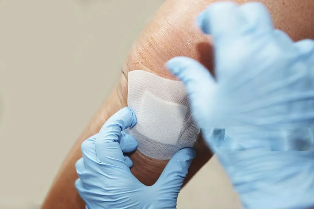 Minor Surgical Procedures